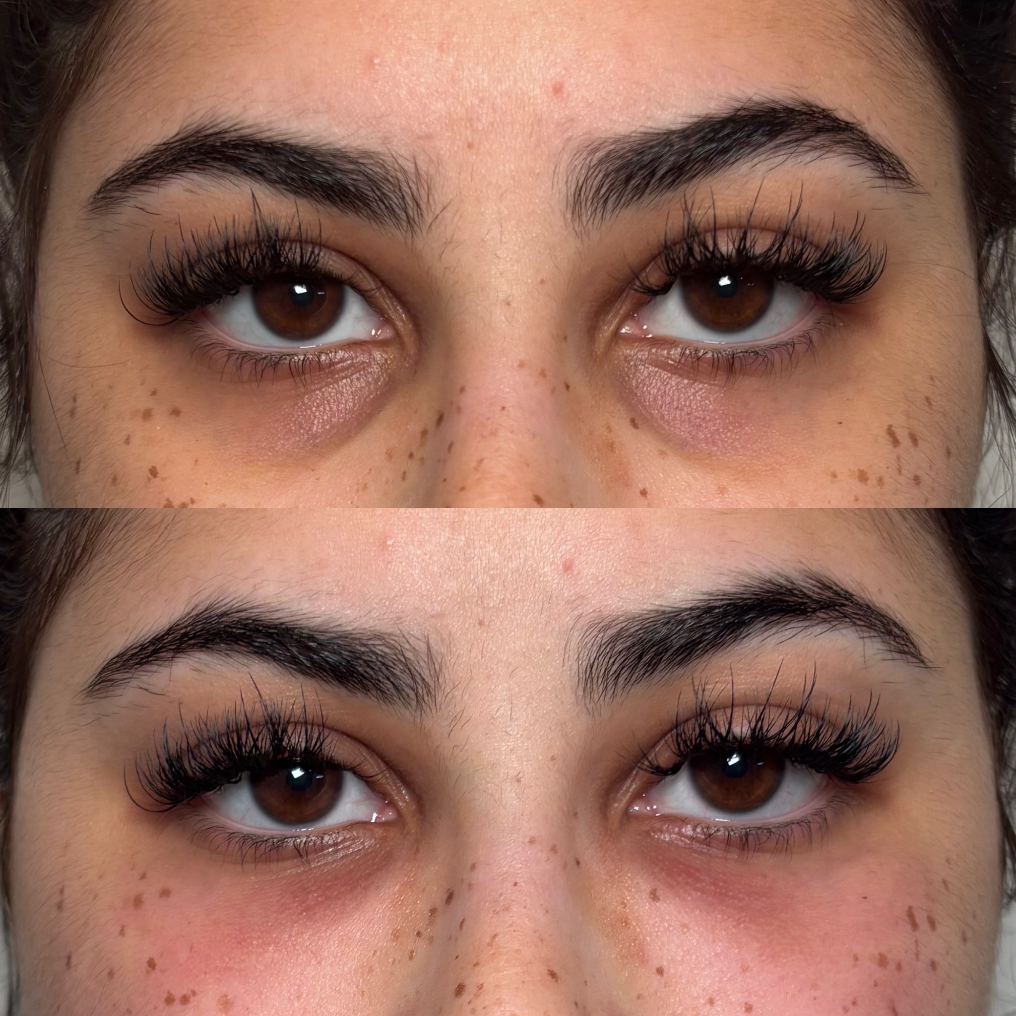 Before and After Image: PRF for Face - front